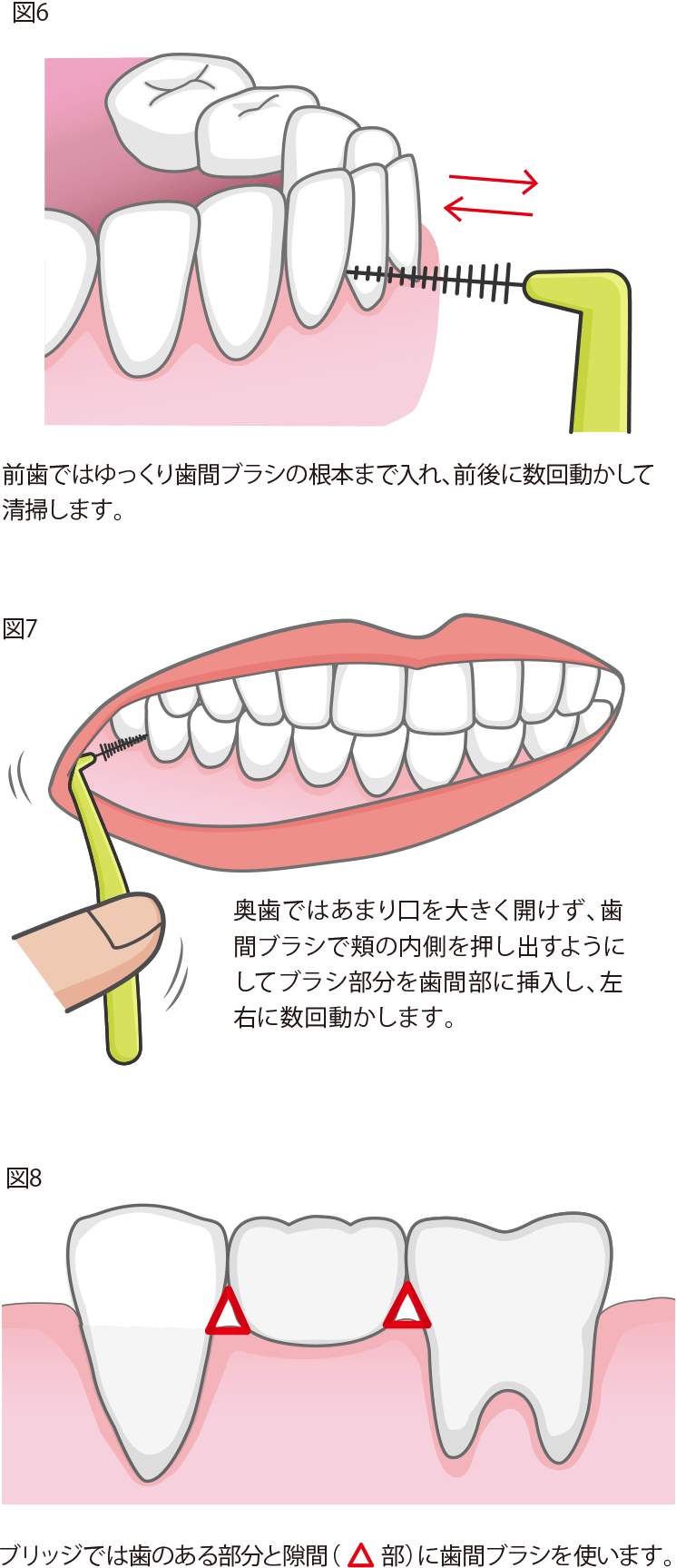 歯間ブラシの使用方法