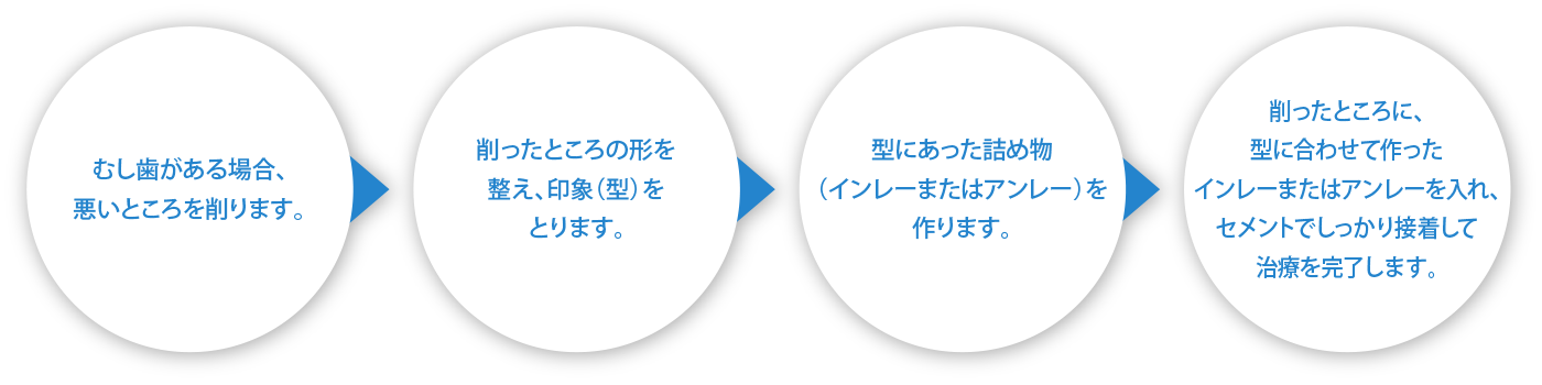 1.むし歯がある場合、悪いところを削ります。2.削ったところの形を整え、印象（型）をとります。3.型にあった詰め物（インレーまたはアンレー）を作ります。3.削ったところに、型に合わせて作ったインレーまたはアンレーを入れ、セメントでしっかり接着して治療を完了します。