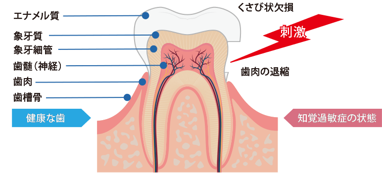 気になる口臭