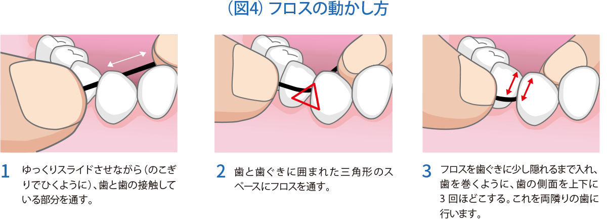 デンタルフロスの選び方